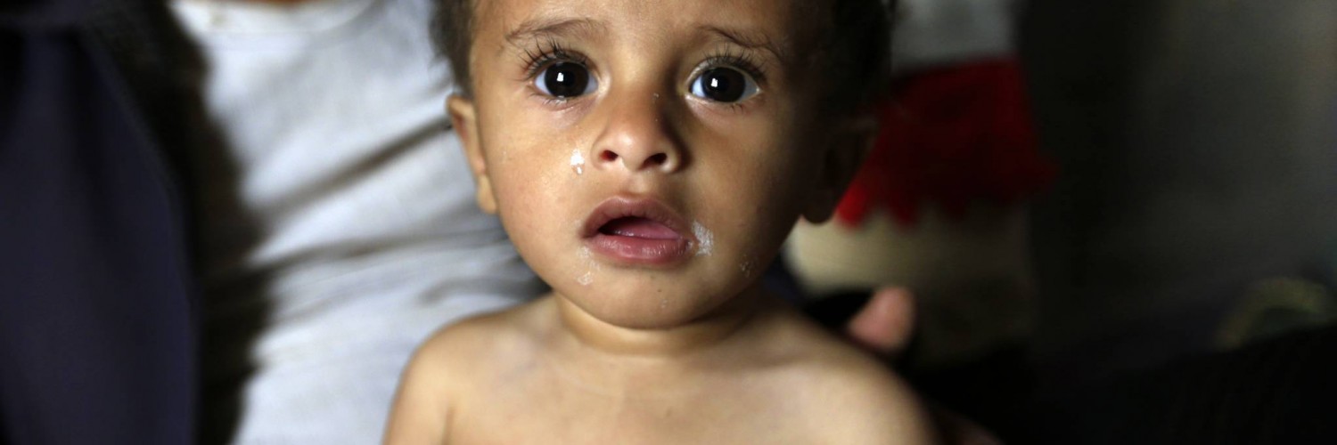 Yemen – “A Living hell for children”
